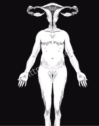 凯利霍普金斯维尔