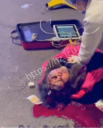 福州闽侯南屿车祸